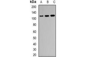 Western blot analysis of CD21 expression in Raji (A), KB (B), NIH3T3 (C) whole cell lysates. (CD21 Antikörper)