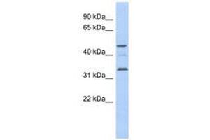 CCNYL1 Antikörper  (AA 71-120)