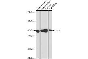 Western Blotting (WB) image for anti-Docking Protein 4 (DOK4) (AA 240-326) antibody (ABIN3020722)