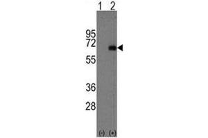 Western blot analysis of AFP antibody and 293 cell lysate either nontransfected (Lane 1) or transiently transfected with the AFP gene (2). (alpha Fetoprotein Antikörper  (AA 300-329))