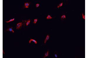 Immunofluorescence (fixed cells) (IF/ICC) image for anti-Caspase 10, Apoptosis-Related Cysteine Peptidase (CASP10) antibody (ABIN6260480)