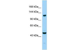Host: Rabbit Target Name: Agtpbp1 Sample Type: Mouse Testis lysates Antibody Dilution: 1.