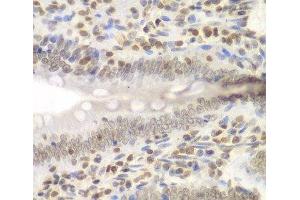 Immunohistochemistry of paraffin-embedded Rat Intestine using UHRF2 Polyclonal Antibody at dilution of 1:200 (40x lens). (UHRF2 Antikörper)