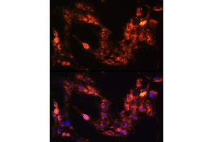 Immunofluorescence analysis of C6 cells using GRM1 Rabbit pAb  at dilution of 1:100 (40x lens). (Metabotropic Glutamate Receptor 1 Antikörper  (AA 921-1010))