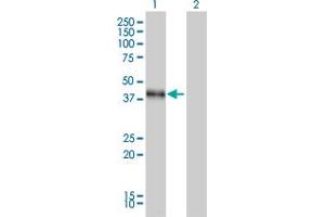 Western Blot analysis of DLX3 expression in transfected 293T cell line by DLX3 monoclonal antibody (M01), clone 4F8. (DLX3 Antikörper  (AA 1-287))