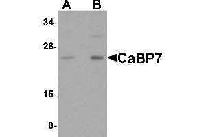 Western Blotting (WB) image for anti-Calcium Binding Protein 7 (CABP7) (N-Term) antibody (ABIN1031287) (CABP7 Antikörper  (N-Term))