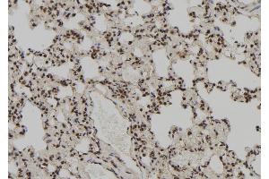 ABIN6272384 at 1/100 staining Rat lung tissue by IHC-P. (PEG3 Antikörper)