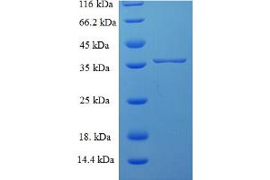SNX24 Protein (AA 1-169, full length) (His-SUMO Tag)