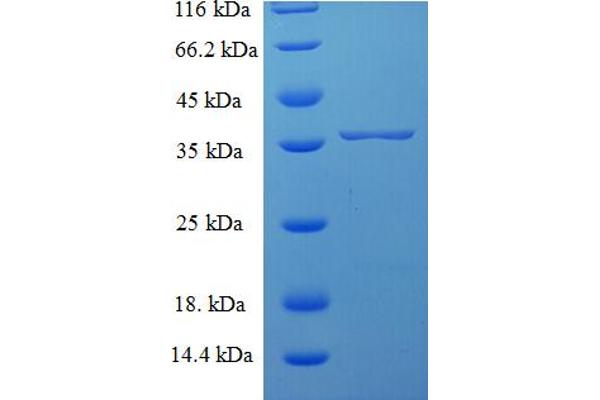 SNX24 Protein (AA 1-169, full length) (His-SUMO Tag)