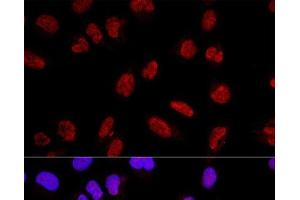 Confocal immunofluorescence analysis of U2OS cells using AKAP8 Polyclonal Antibody at dilution of 1:200. (AKAP8 Antikörper)