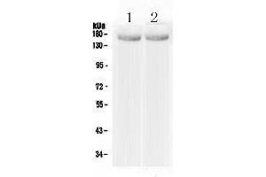Western blot analysis of MED14 using anti-MED14 antibody . (MED14 Antikörper  (AA 181-375))