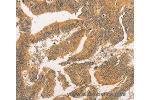Immunohistochemistry of Human tonsil using BCL2L14 Polyclonal Antibody at dilution of 1:40 (BCL2L14 Antikörper)