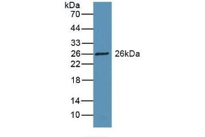 Detection of Recombinant RBP3, Rat using Polyclonal Antibody to Retinol Binding Protein 3, Interstitial (RBP3) (RBP3 Antikörper  (AA 1027-1229))