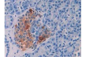 Detection of ENA78 in Human Pancreas Tissue using Polyclonal Antibody to Epithelial Neutrophil Activating Peptide 78 (ENA78) (CXCL5 Antikörper  (AA 38-114))