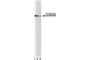 Western blot analysis of PI3-Kinase p110alpha on Jurkat lysate. (PIK3CA Antikörper  (AA 101-300))