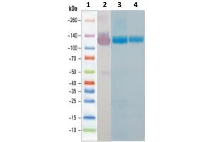 WB and coomassie of S1-His protein. (SARS-CoV-2 Spike Protein (His tag))