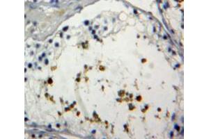 IHC-P analysis of Testis tissue, with DAB staining. (FOXP1 Antikörper  (AA 461-671))