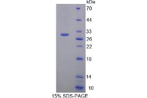 Image no. 1 for Plexin B1 (PLXNB1) (AA 1598-1849) protein (His tag) (ABIN4990691)