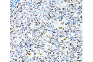 Immunohistochemistry of paraffin-embedded Human appendix using XRCC4 Polyclonal Antibody at dilution of 1:100 (40x lens). (XRCC4 Antikörper)