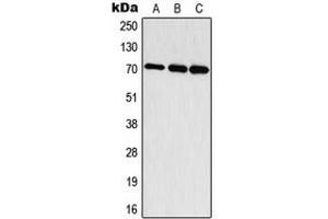 Western blot analysis of S6K1 (pT444) expression in HepG2 EGF-treated (A), mouse brain (B), rat brain (C) whole cell lysates. (RPS6KB1 Antikörper  (C-Term, pSer444))