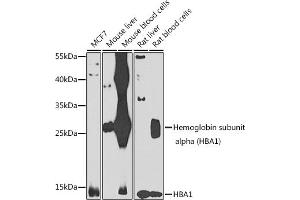 Western blot analysis of extracts of various cell lines, using Hemoglobin subunit alpha (Hemoglobin subunit alpha (HB)) antibody (ABIN6128046, ABIN6141635, ABIN6141636 and ABIN6223164) at 1:1000 dilution. (HBA1 Antikörper  (AA 1-142))