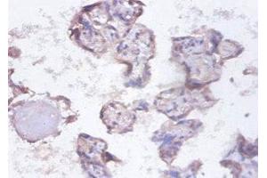 Immunohistochemistry of paraffin-embedded human placenta tissue using ABIN7155134 at dilution of 1:100 (SYNCRIP Antikörper  (AA 2-191))