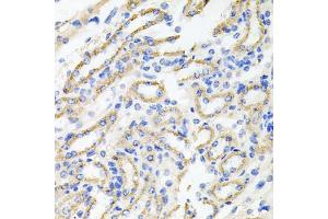 Immunohistochemistry of paraffin-embedded mouse kidney using IRAK2 antibody. (IRAK2 Antikörper)