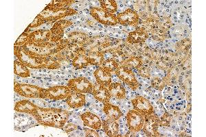 ABIN7096825 and ABIN7100891 at 1/100 staining mouse kidney tissue by IHC-P.
