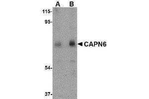 Western blot analysis of CAPN6 in rat lung tissue lysate with AP30177PU-N CAPN6 antibody at (A) 0. (Calpain 6 Antikörper  (C-Term))