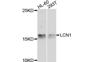 Western blot analysis of extracts of HL60 and 293T cells, using LCN1 antibody. (Lipocalin 1 Antikörper)