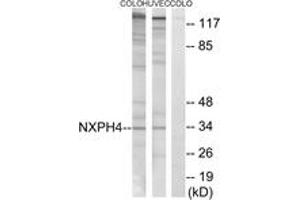 Western blot analysis of extracts from COLO/HuvEc cells, using NXPH4 Antibody. (Neurexophilin 4 Antikörper  (AA 216-265))