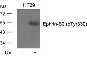 Western blot analysis of extracts from HT29 cells, untreated or treated with UV using Ephrin-B2(Phospho-Tyr330) Antibody. (Ephrin B2 Antikörper  (pTyr330))
