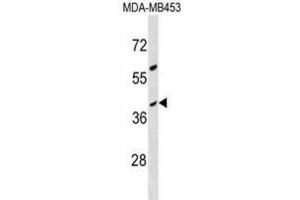 Western Blotting (WB) image for anti-Olfactory Receptor, Family 10, Subfamily G, Member 8 (OR10G8) antibody (ABIN3000509) (OR10G8 Antikörper)