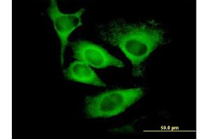 Immunofluorescence of monoclonal antibody to EIF5 on HeLa cell. (EIF5 Antikörper  (AA 1-431))