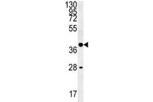 WNT8B antibody western blot analysis in K562 lysate (WNT8B Antikörper  (AA 323-351))