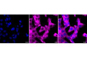 Immunocytochemical staining of HT- cells with CTP synthase 1 antibody (ABIN7798174), 1:1,000). (Rekombinanter CTP Synthase Antikörper)