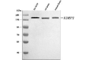 Western blot analysis of RIMBP2 using anti-RIMBP2 antibody (ABIN7601441). (RIMBP2 Antikörper  (AA 351-1049))