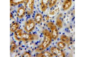 Used in DAB staining on fromalin fixed paraffin-embedded kidney tissue (Profilin 3 Antikörper  (AA 1-133))