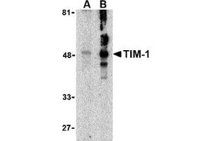 Western blot analysis of TIM-1 in human uterus tissue lysate with this product at (A) 1 and (B) 2 μg/ml. (HAVCR1 Antikörper  (N-Term))