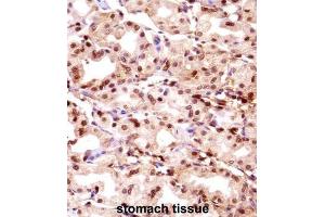 Immunohistochemistry (IHC) image for anti-Thymopoietin (TMPO) antibody (ABIN2998199)