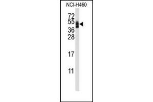 Image no. 1 for anti-Coxsackie Virus and Adenovirus Receptor (CXADR) (AA 140-169), (Middle Region) antibody (ABIN358032)