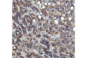 IHC analysis of RRS1 using anti-RRS1 antibody (ABIN7602918). (RRS1 Antikörper  (C-Term))