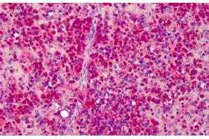 Human Spleen: Formalin-Fixed, Paraffin-Embedded (FFPE) (beta Actin Antikörper  (C-Term))