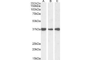 Western Blotting (WB) image for anti-Dimethylarginine Dimethylaminohydrolase 1 (DDAH1) (C-Term) antibody (ABIN184669)