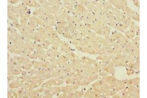 Immunohistochemistry of paraffin-embedded human heart tissue using ABIN7150306 at dilution of 1:100 (DNA2 Antikörper  (AA 1-300))