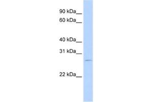 Western Blotting (WB) image for anti-RNA Binding Motif Protein 38 (RBM38) antibody (ABIN2462271) (RBM38 Antikörper)