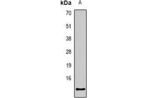 Western blot analysis of CCL27 expression in mouse kidney (A) whole cell lysates. (CCL27 Antikörper)