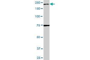 A2M MaxPab rabbit polyclonal antibody. (alpha 2 Macroglobulin Antikörper  (AA 1-1474))