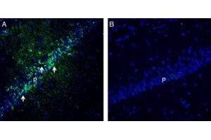 Expression of PACSIN1 in rat hippocampus. (Protein Kinase C and Casein Kinase Substrate in Neurons 1 (PACSIN1) Peptid)