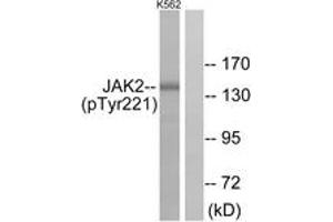 Western blot analysis of extracts from K562 cells, using JAK2 (Phospho-Tyr221) Antibody. (JAK2 Antikörper  (pTyr221))
